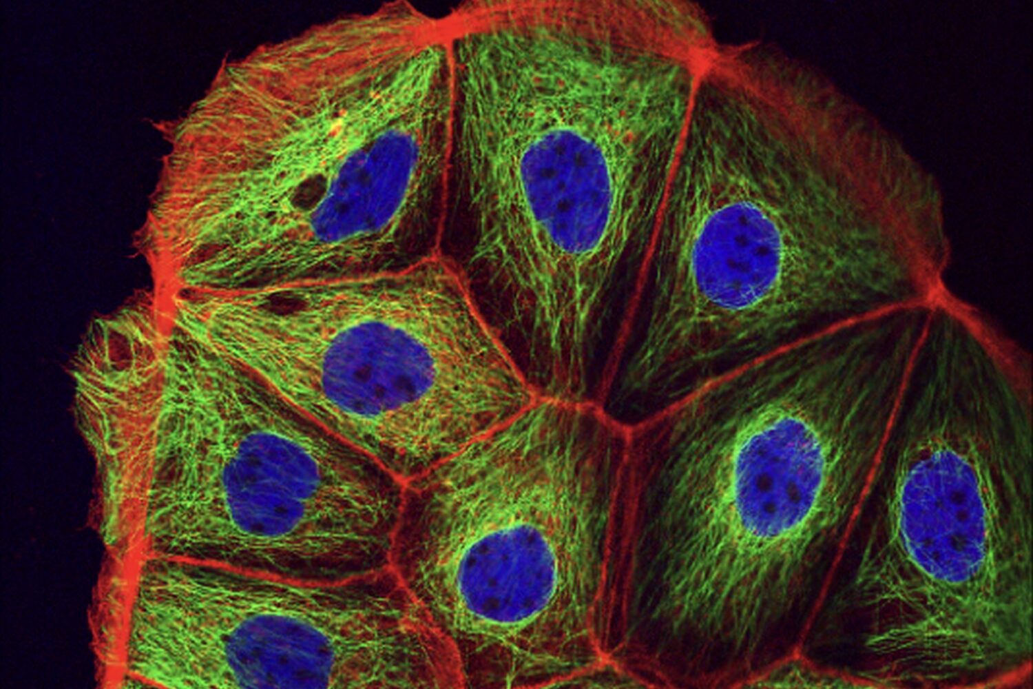 Cancer Biology